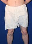 DISPSHORTS